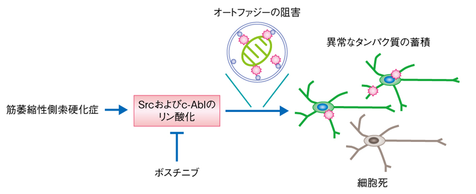 筋萎縮性側索硬化症の患者の運動ニューロンにおける病態
